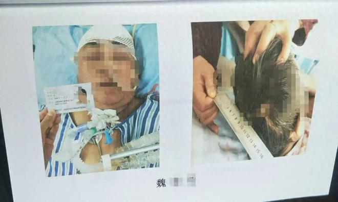 目睹母亲过马路被车撞，27岁女子受惊吓5天后身亡-梵星网